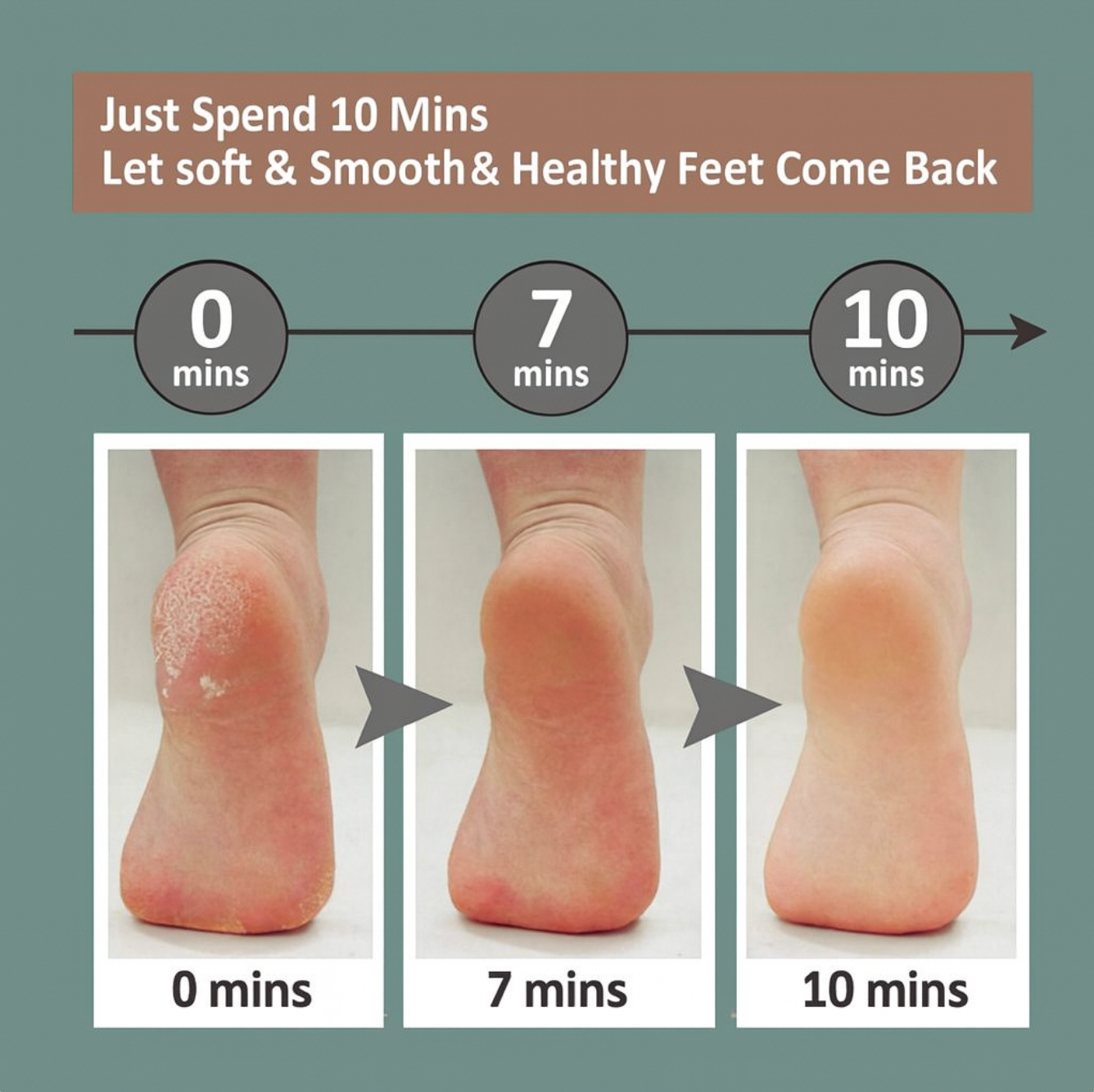 Velivia™ Electric Foot & Nail Care File