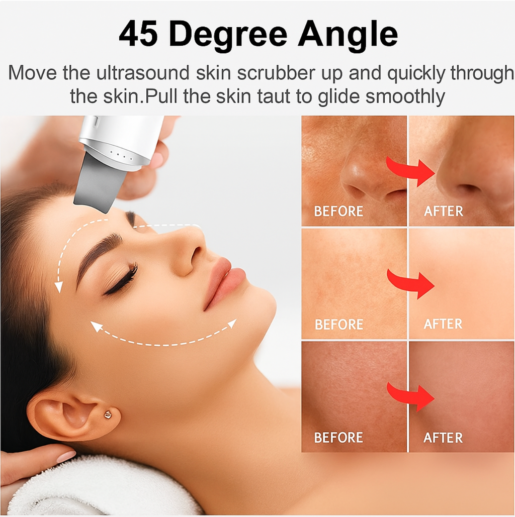 Velivia™ Ultrasonic Facial Cleansing Scrubber