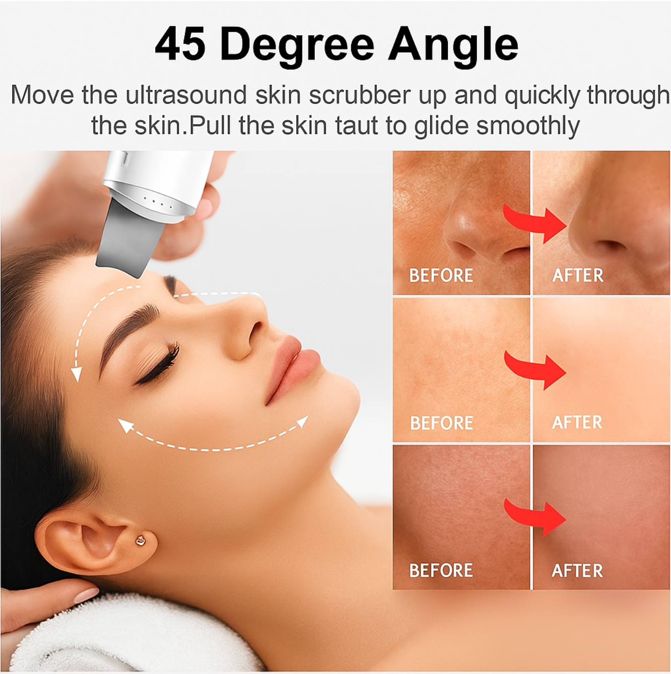 Velivia™ Ultrasonic Facial Cleansing Scrubber