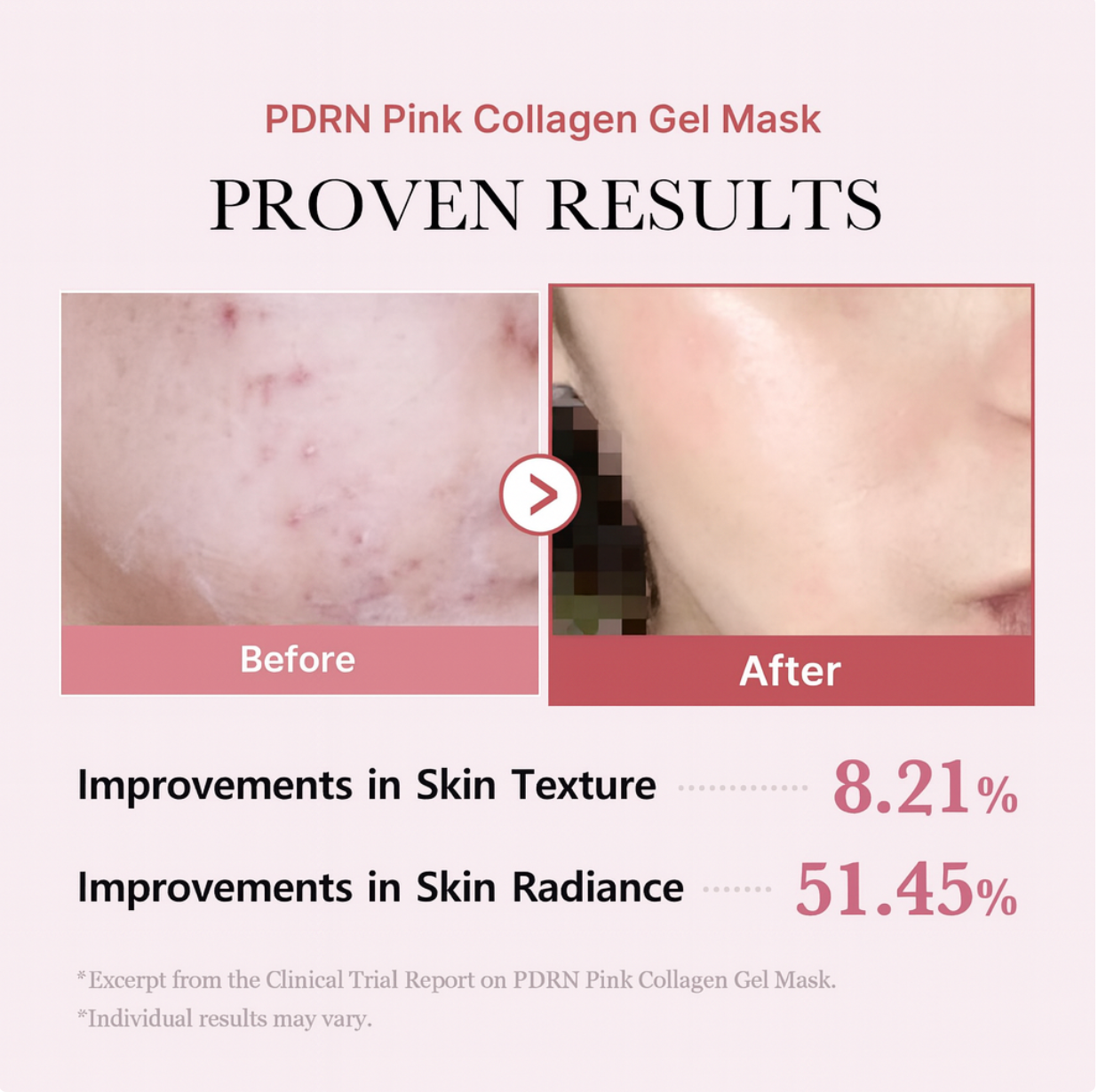 Velivia™ Hydrating Repair Facial Mask