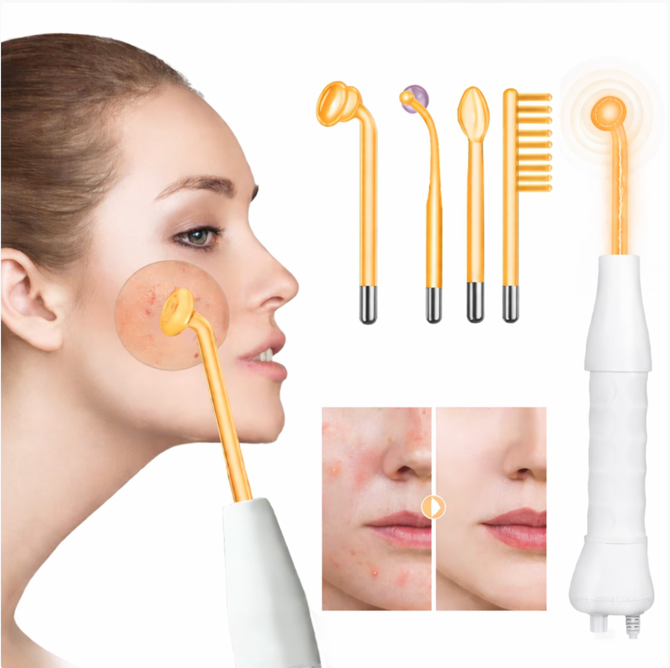 Velivia™ ClearSonic